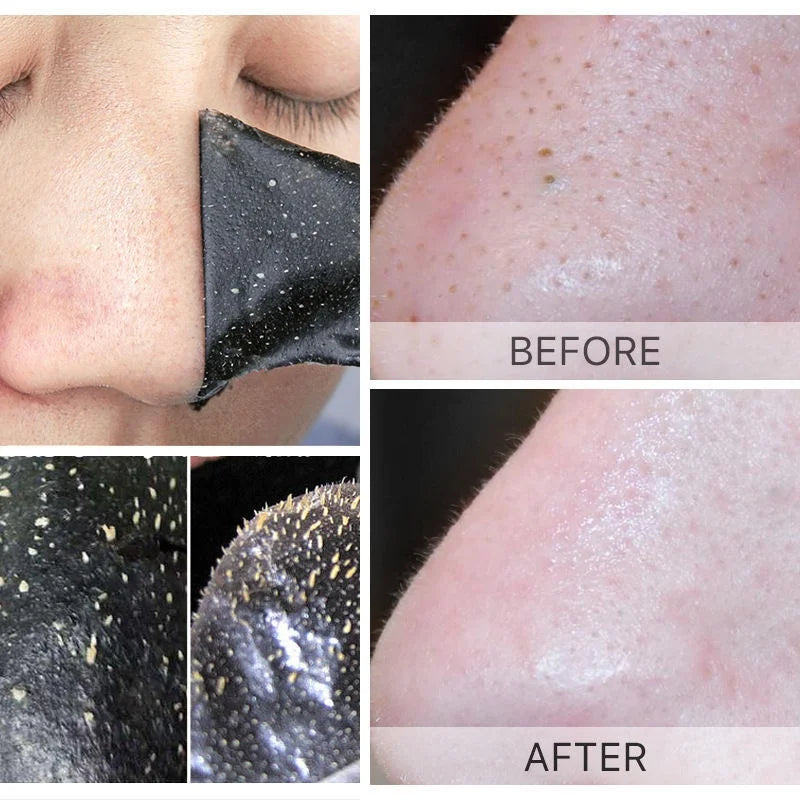 Blackhead Remove Mask Peel Nasal